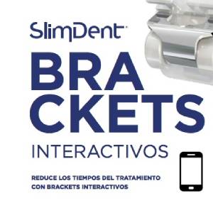 Brackets Interactivos Slimdent